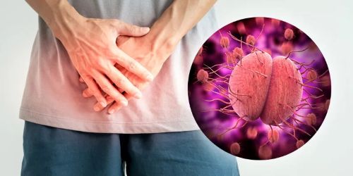 Jual Obat Gonore Keluar Nanah Dari Saluran Kencing Rawa Buaya Jakarta Barat